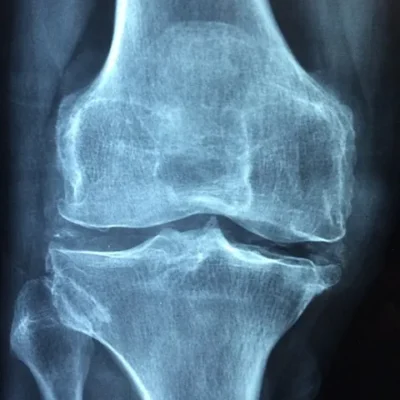 knee 1406964_640